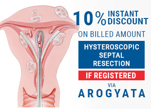 10% Instant Discount On Billed Amount Of Hysteroscopic Septal Resection Treatment