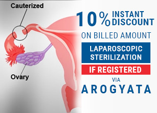 10% Instant Discount On Billed Amount Of Laparoscopic Sterilization Treatment